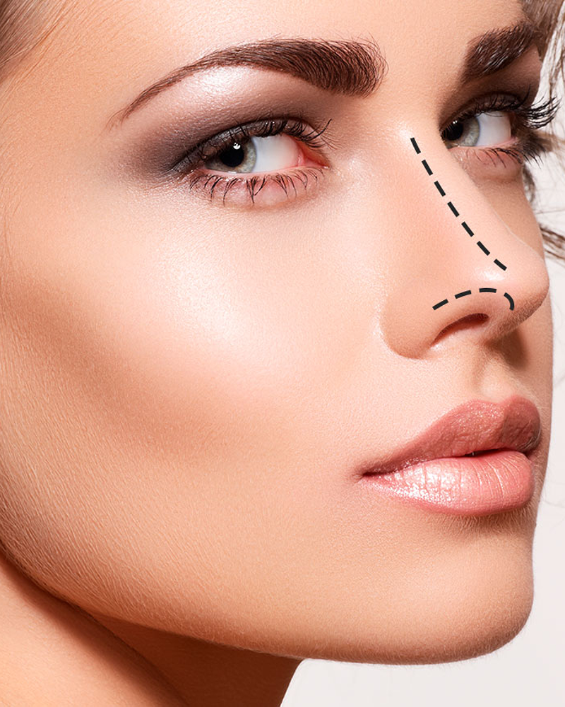 This image for Image Layouts addon